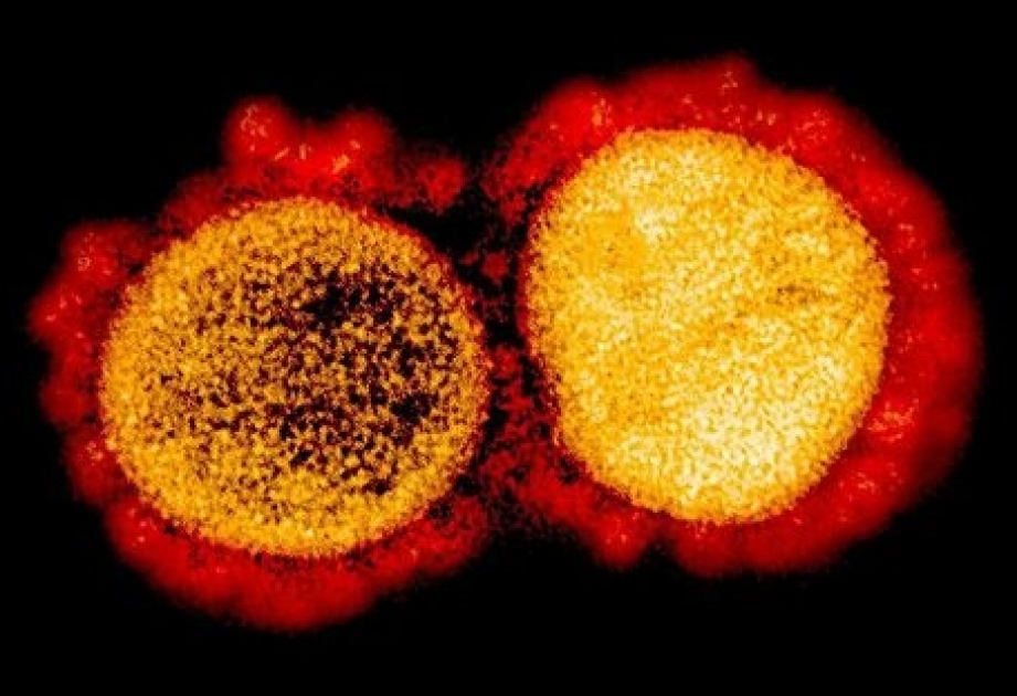 ÜST koronavirus əleyhinə peyvənd təşəbbüsünə 172 ölkənin qoşulacağına ümid bəsləyir