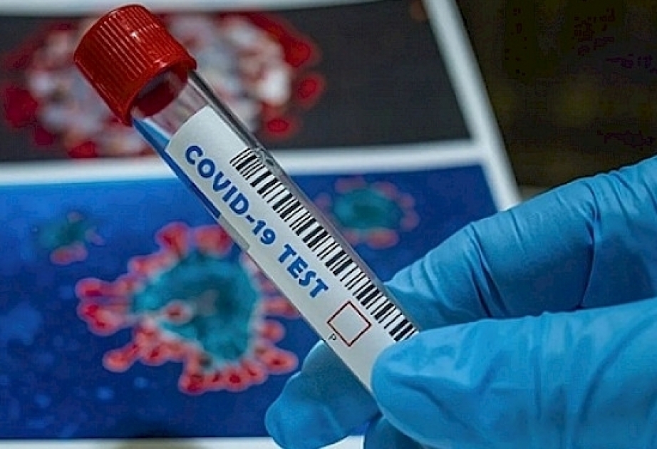 125 new coronavirus infections reported in Kyrgyzstan bring total to 43,712