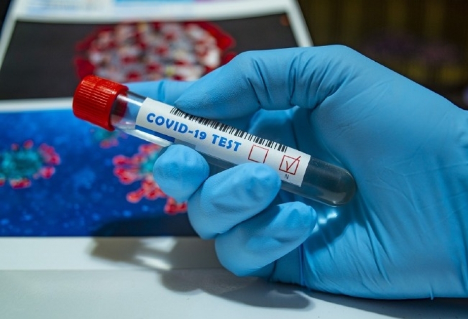 Ermənistanda koronavirus xəstələrinin sayı 44 mini keçib
