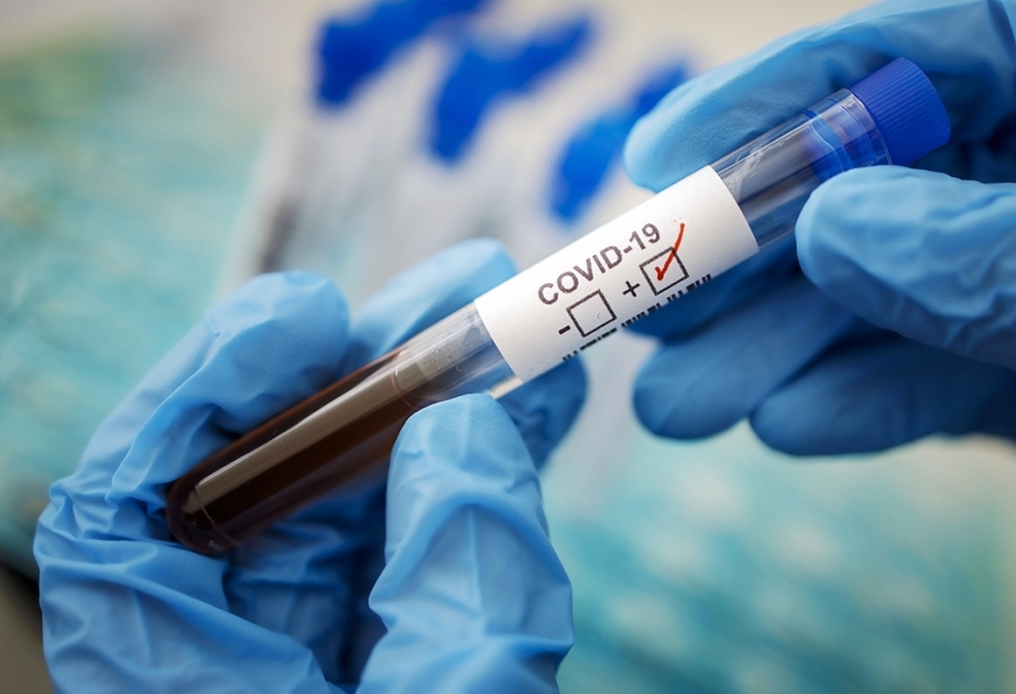 Le nombre de tests de dépistage du COVID-19 réalisés en Azerbaïdjan rendu public