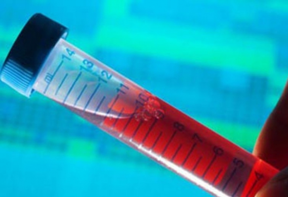 Azərbaycanda 4 min nəfərdən çox talassemiya xəstəsi var