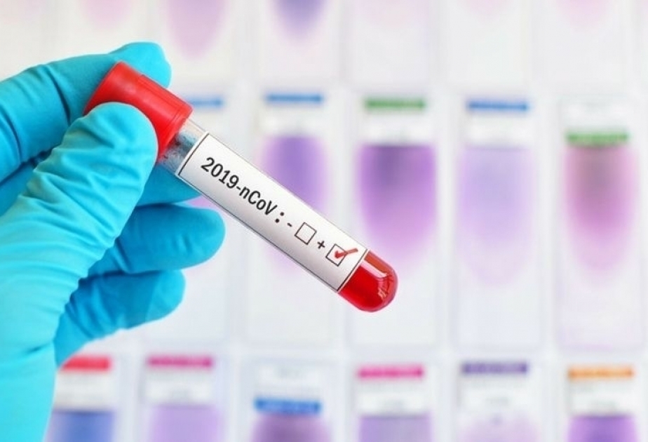 El número de pruebas de COVID-19 realizadas en Azerbaiyán ha superado el millón