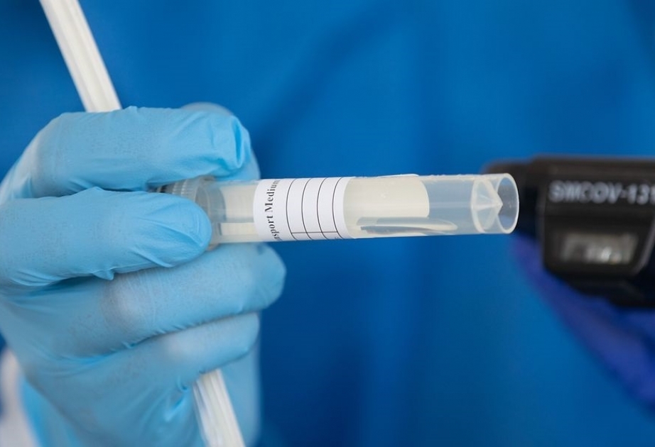 COVID-19: Lüksemburqda koronavirus xəstələrinin sayı artır