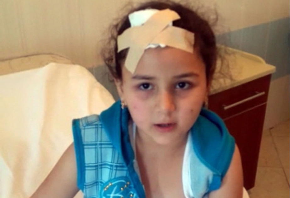 Ermənistanın Gəncəni atəşə tutması nəticəsində yaralananlardan biri də 8 yaşlı qızcığazdır FOTO VİDEO