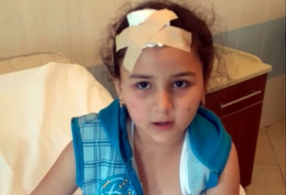 Среди раненых в результате обстрела Гянджи - 8-летняя девочка - ФОТО