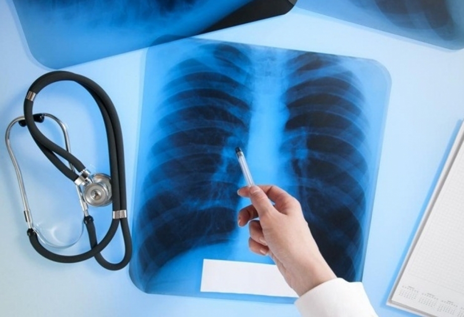ВОЗ: Пандемия осложнила борьбу с туберкулезом
