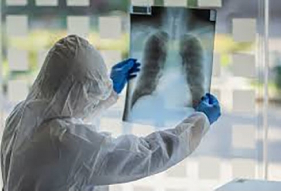 Coronavirus: Infektionszahlen in Georgien steigen weiter