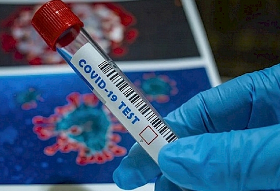 Son sutkada Qırğızıstanda koronavirusa 547 nəfər yoluxub