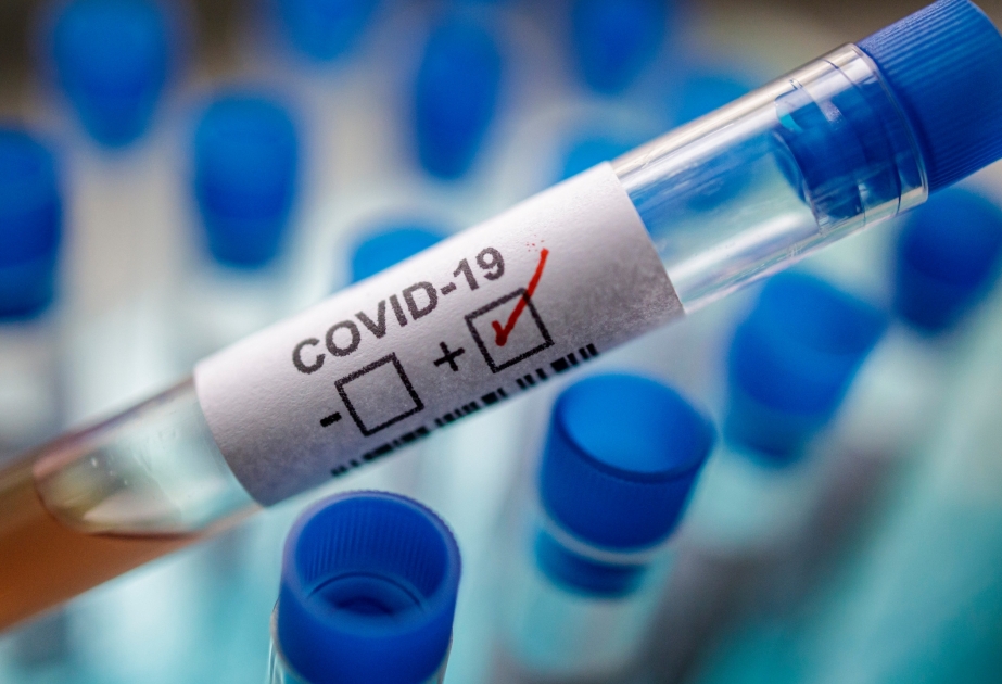 Nepalda COVID-19-a yoluxanların sayı 200 mini ötüb