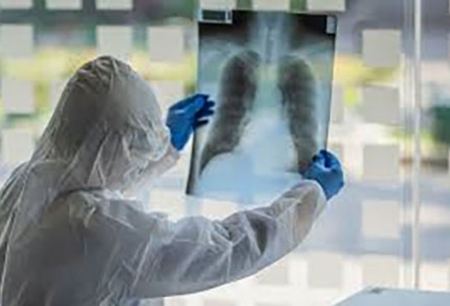 Le bilan du coronavirus en Géorgie