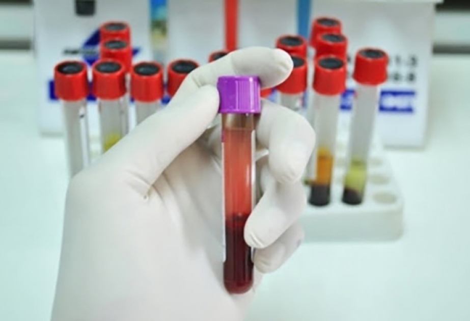 Pakistan sees highest daily virus cases in 4 months