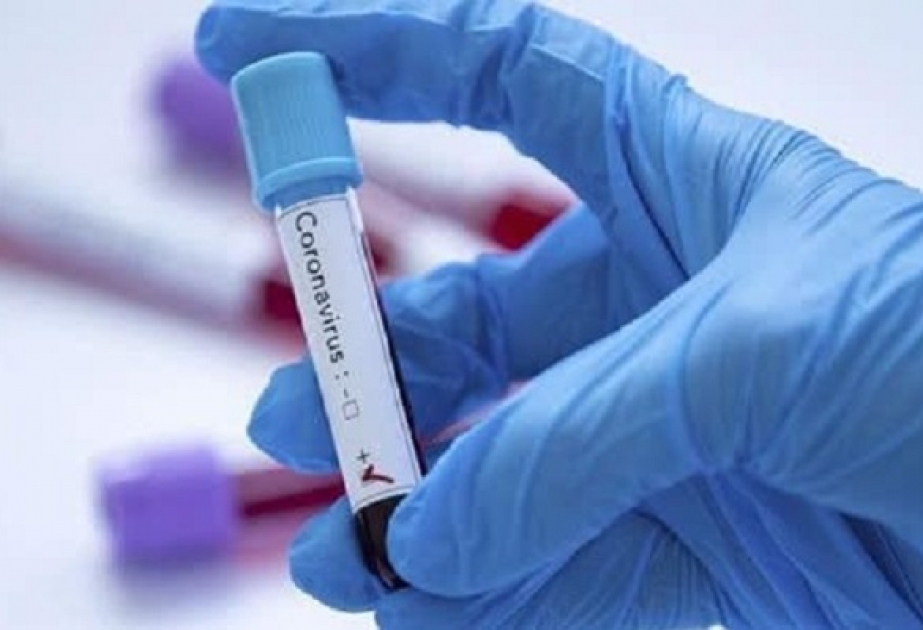 Son sutkada Pakistanda 32 nəfər koronavirusdan həyatını itirib