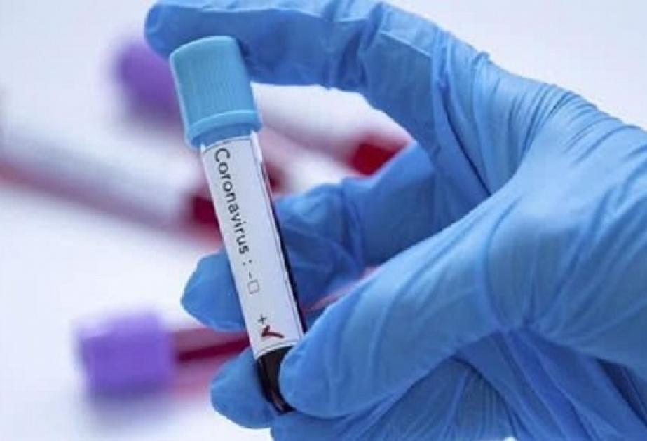 Son sutkada Pakistanda koronavirusdan 33 xəstə dünyasını dəyişib