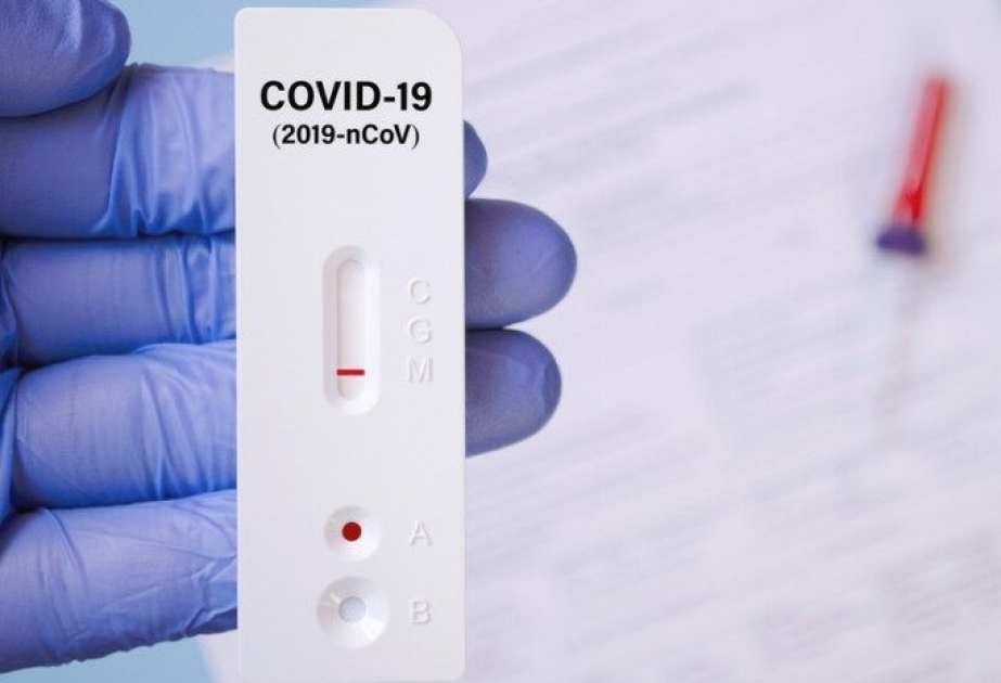 Rumıniyada koronavirusa bir gündə yoluxanların sayı 9 mini keçib