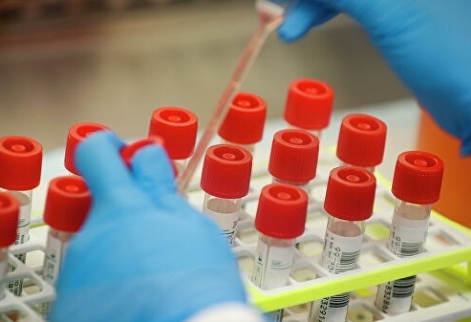 Tres horas antes de la prueba del coronavirus, no se puede beber agua, comer, fumar o usar un spray nasal