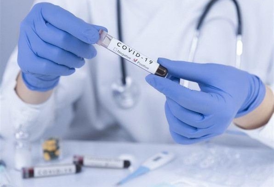 Azərbaycanda koronavirusla əlaqədar aparılan testlərin sayı 2 milyonu ötüb