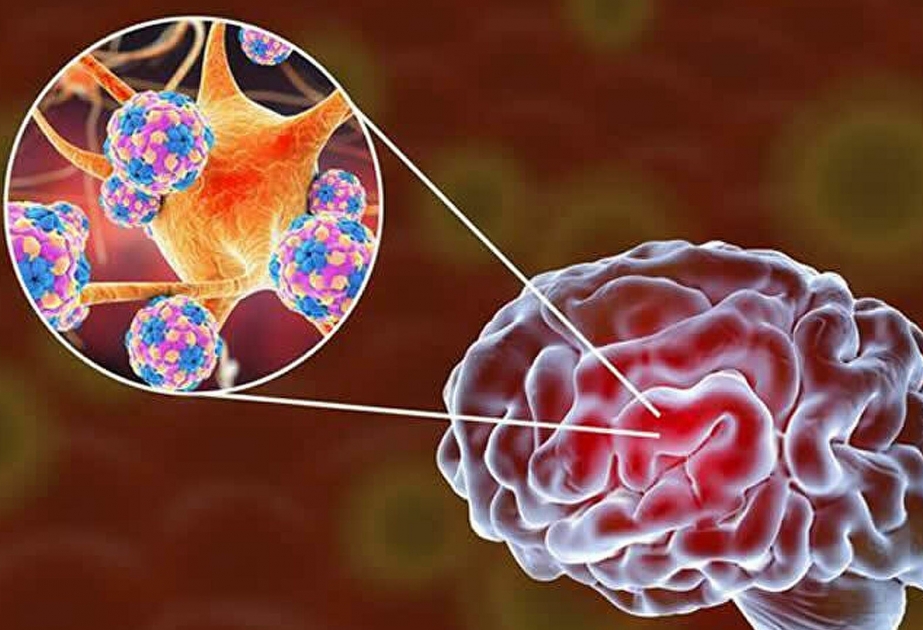 Американские ученые выяснили, с чем связаны повреждения мозга при COVID-19