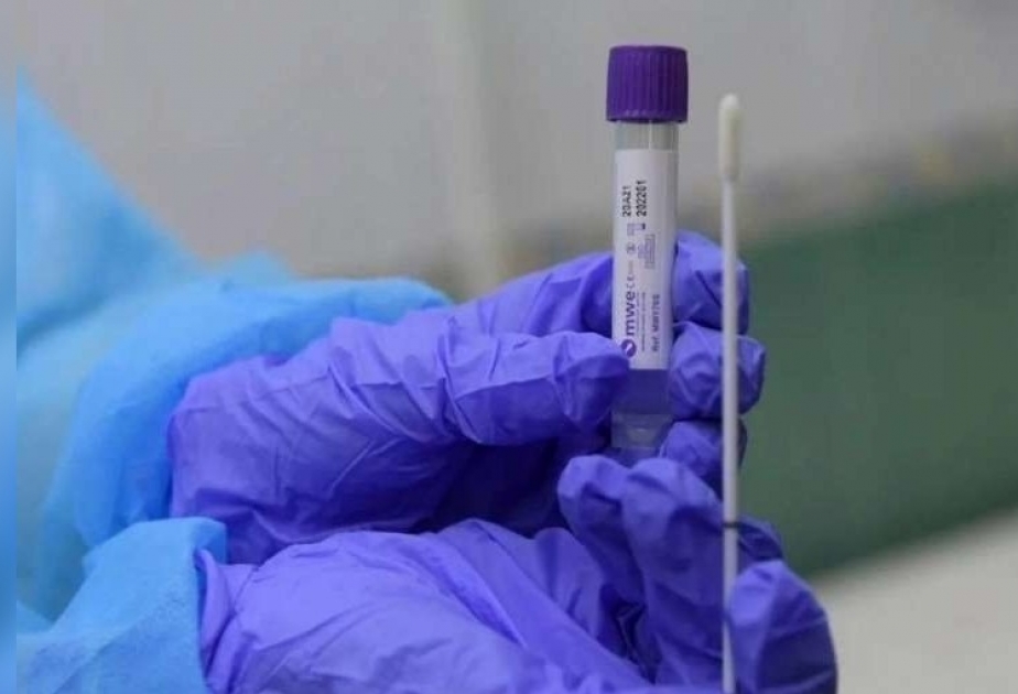 Son 24 saatda Pakistanda koronavirusdan 64 nəfər dünyasını dəyişib