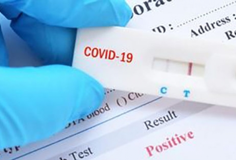 Rumıniyada apteklərdə vətəndaşlar koronavirus testindən keçə biləcəklər