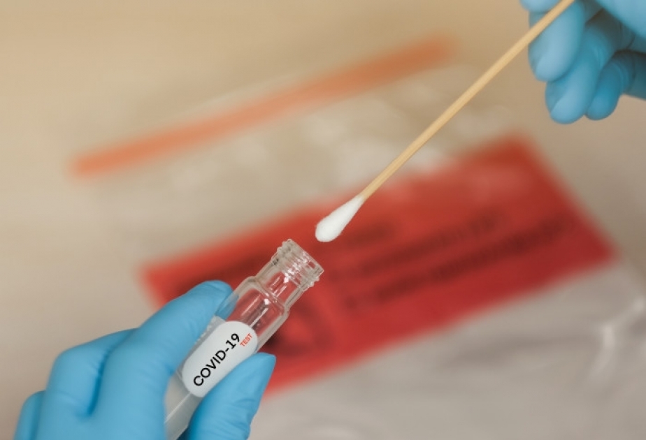 Böyük Britaniyada hər kəs həftədə iki dəfə sürətli koronavirus testindən keçəcək