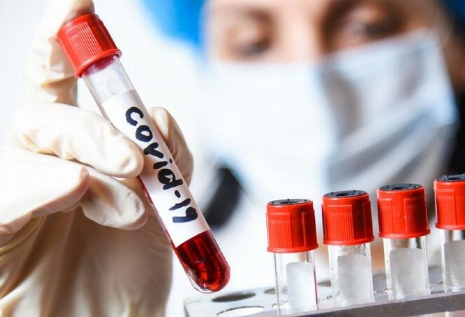 Həkim-endokrinoloq: COVID-19 endokrin sistemdə çoxlu dəyişikliklərə səbəb olur