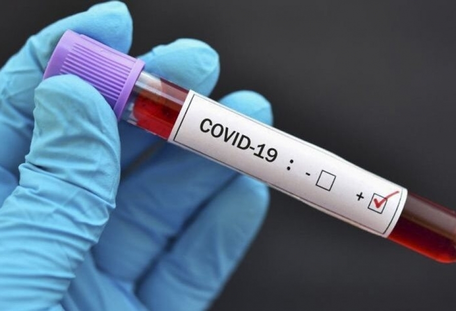 Environ 550 000 cas positifs du Covid-19 enregistrés dans le monde en 24 heures