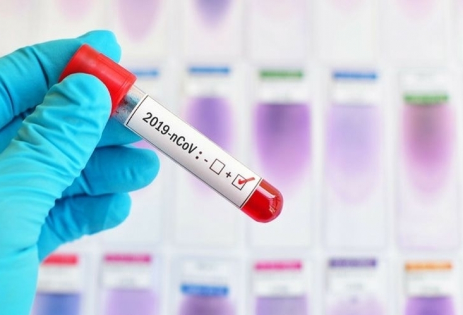 No se ha detectado ninguna cepa delta del coronavirus en Azerbaiyán