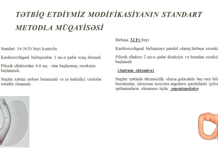 Tariyel Ömərovun aşırı piylənmənin müalicəsində kəşf etdiyi cərrahiyyə metodu növbəti dəfə dünya səviyyəli patentə layiq görülüb