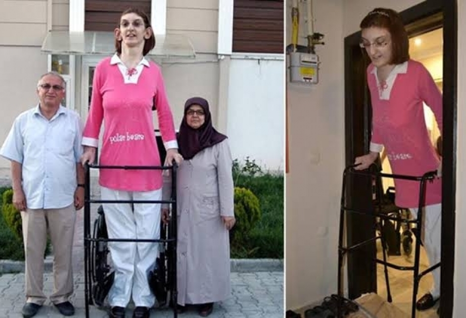 Türkiyəli Rumeysa Gelgi dünyanın ən uzun boylu qadını olaraq “Ginnesin Rekordlar kitabı”na düşüb
