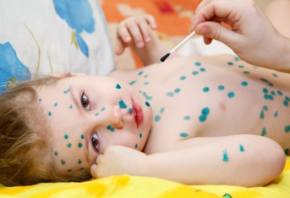 Payız aylarında həm xroniki xəstəliklər kəskinləşir, həm də müxtəlif virus infeksiyalarına yoluxma riski artır