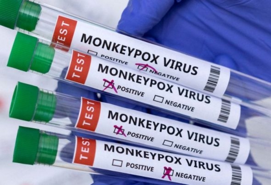 英国猴痘病例增至90例