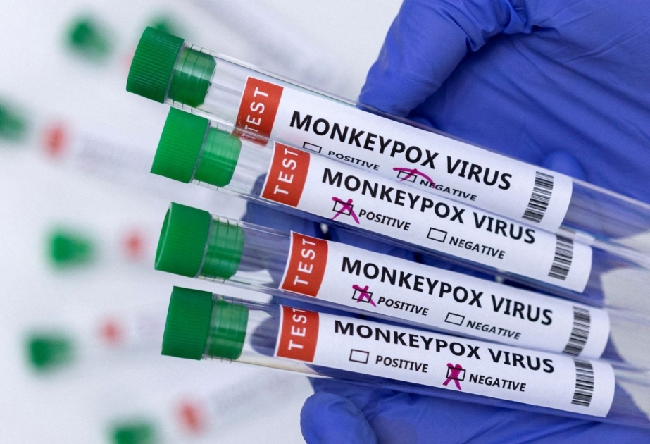 Variole du singe : plus de 900 cas confirmés dans le monde