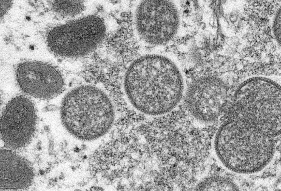 L’OMS ne recommande pas la vaccination de masse contre la variole du singe