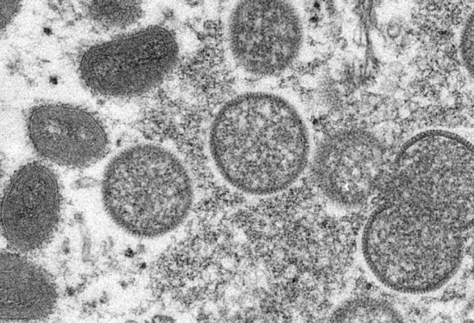 L’OMS décidera la semaine prochaine si la variole du singe représente une urgence sanitaire internationale