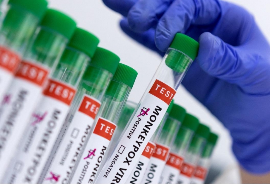 Mpox test. Mpox test