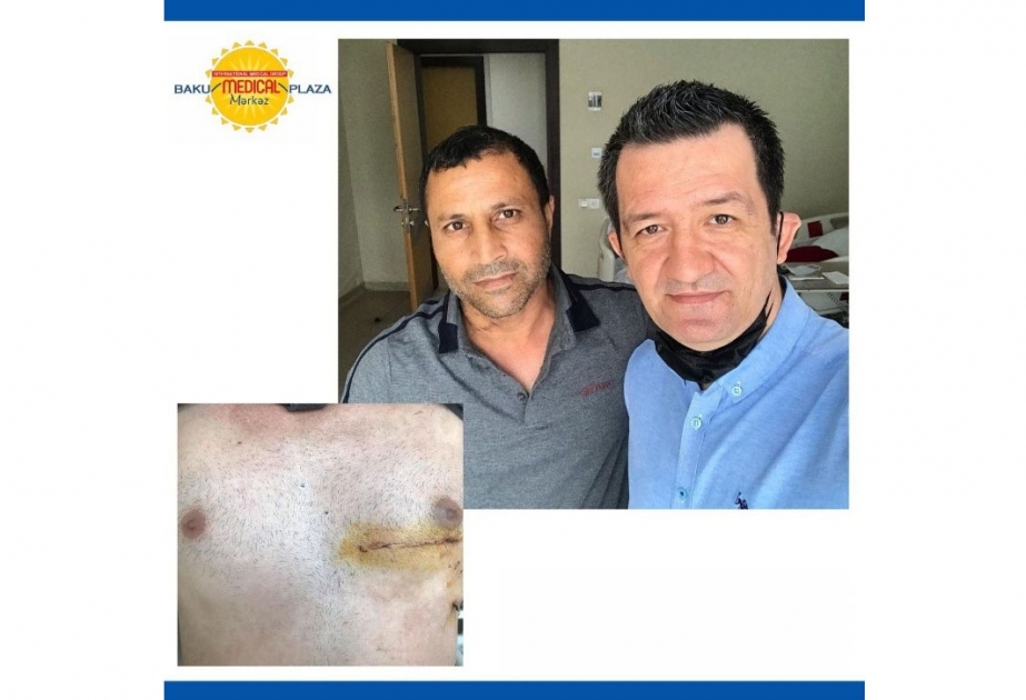 ®  Ürək əməliyyatlarında ən müasir üsul olan endoskopik yolla damar çıxarma əməliyyatı yalnız “Baku Medical Plaza”da