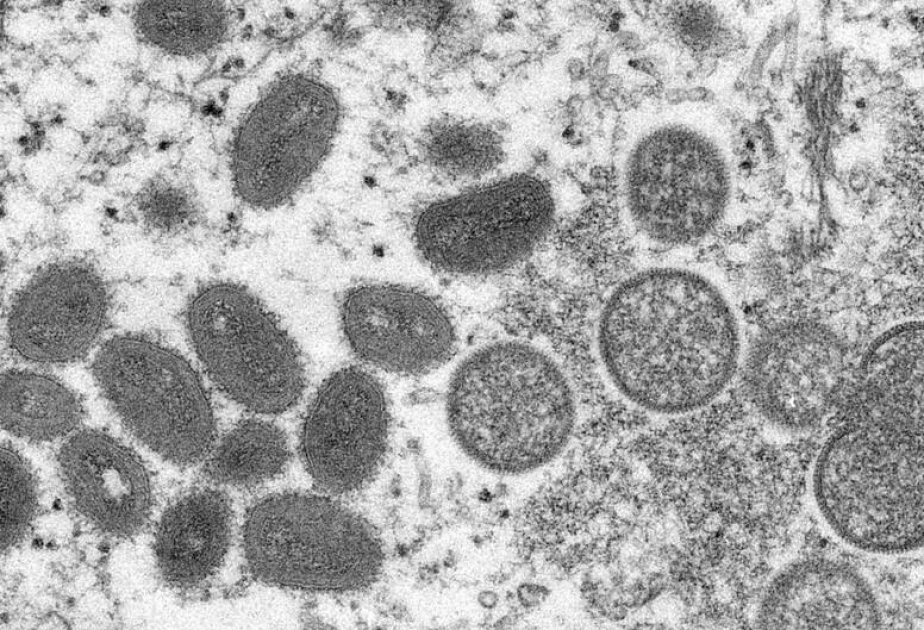 世卫组织：全球已报告超5000例猴痘病例
