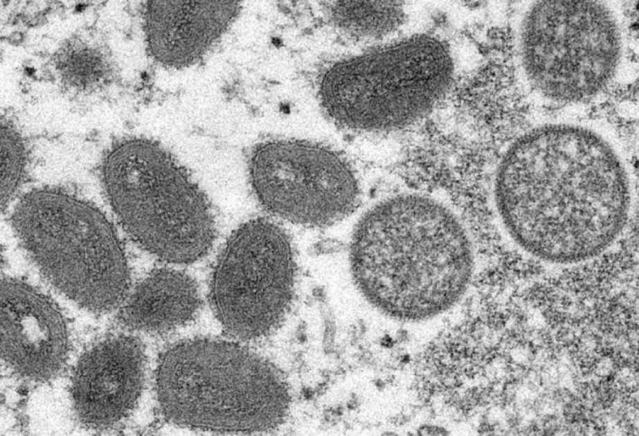 Variole du singe : plus de 6 000 cas enregistrés dans le monde