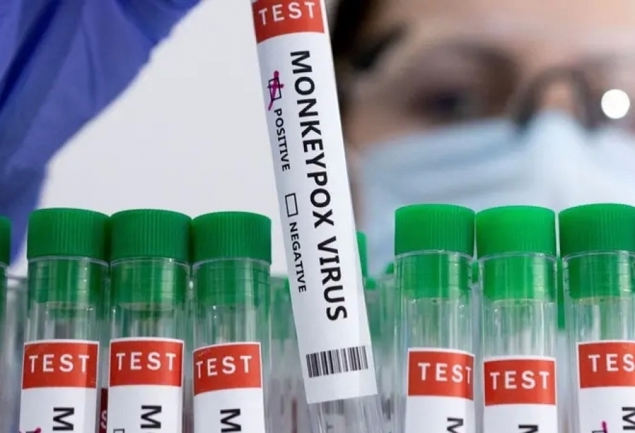 Saudi Arabia reports first case of Monkeypox