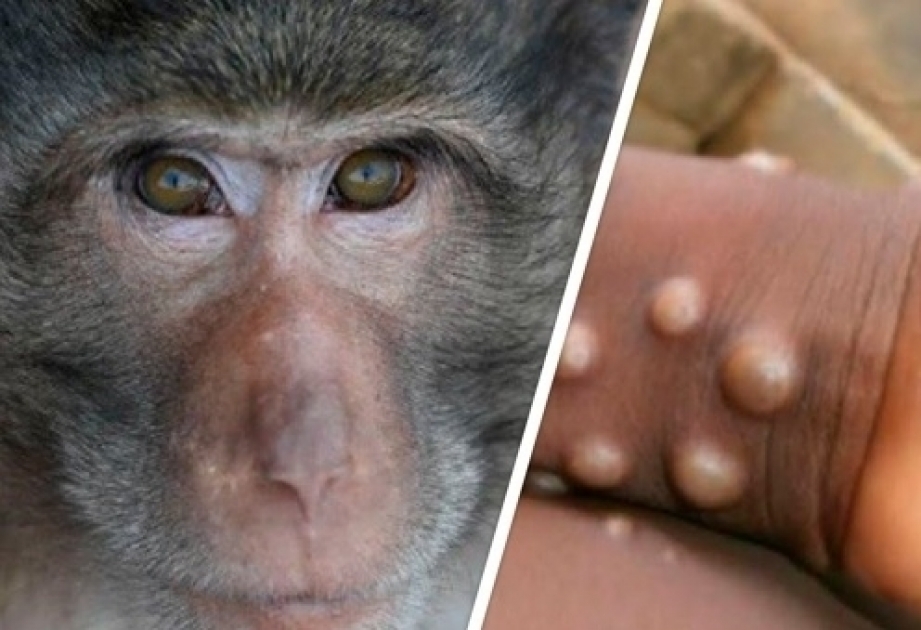 OMS: “Aumenta la transmisión de enfermedades entre animales en África”
