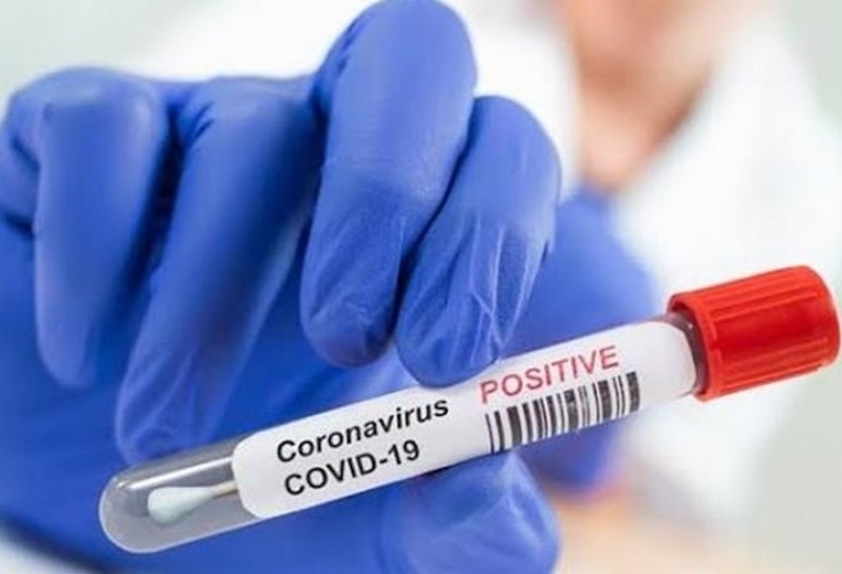 Son bir həftədə Moldovada 10 minə yaxın insan koronavirusa yoluxub