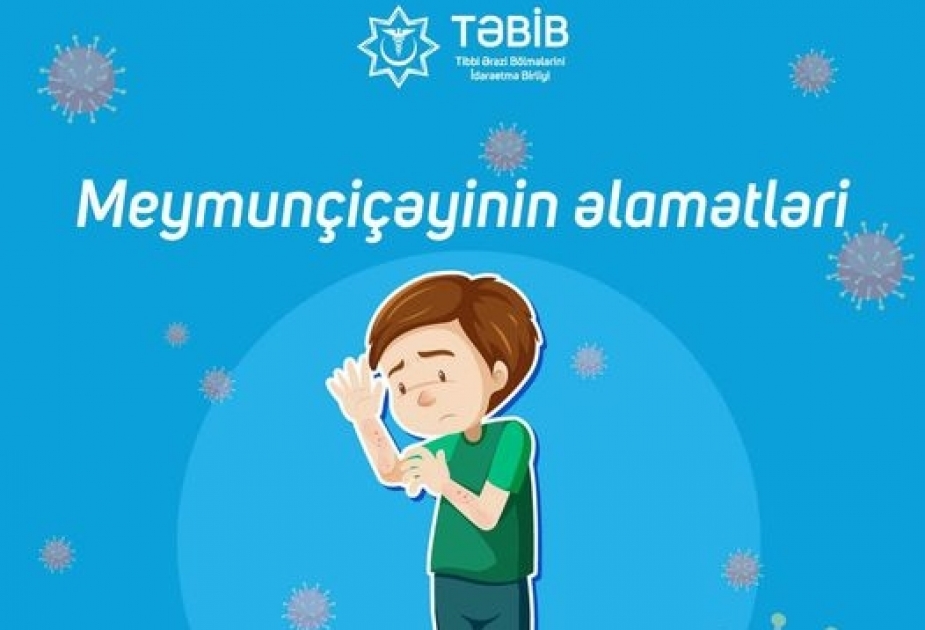 TƏBİB: Meymunçiçəyi xəstəliyinə yoluxduğunuzu düşünürsünüzsə həkiminizlə əlaqə saxlayın