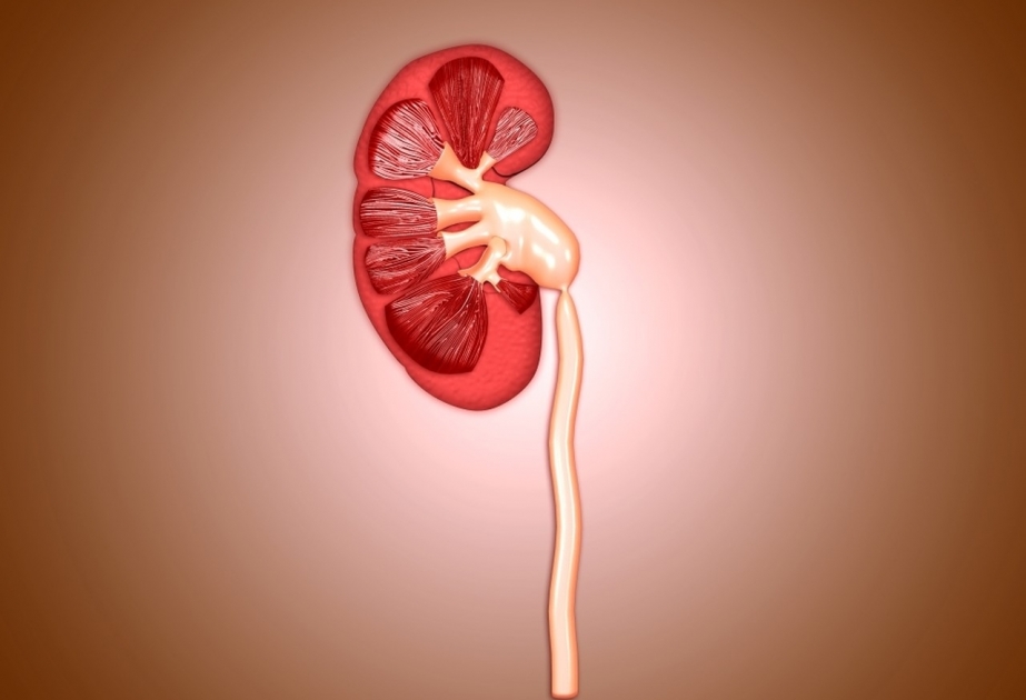 ®  Ureteropelvik Tıxac