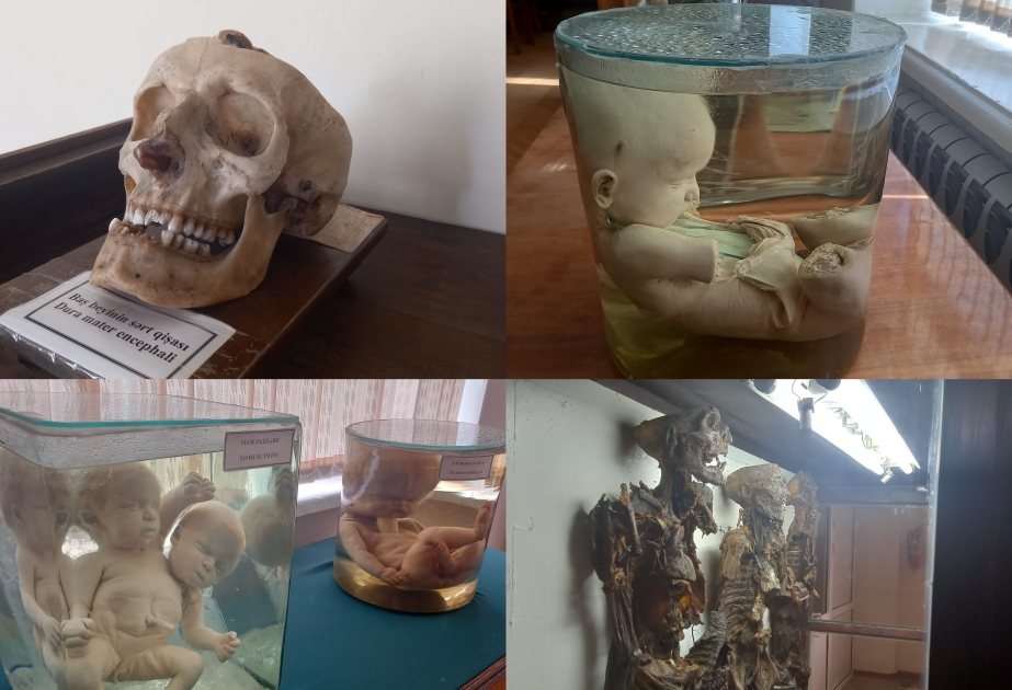 Mumiyalar, siam əkizləri, müxtəlif formalı insan beyinləri, uşaq skletləri və daha nələr… FOTO VİDEO