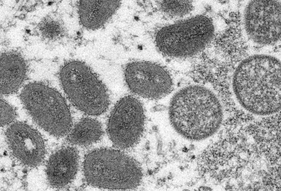 La Commission européenne achète des traitements pour lutter contre la variole du singe