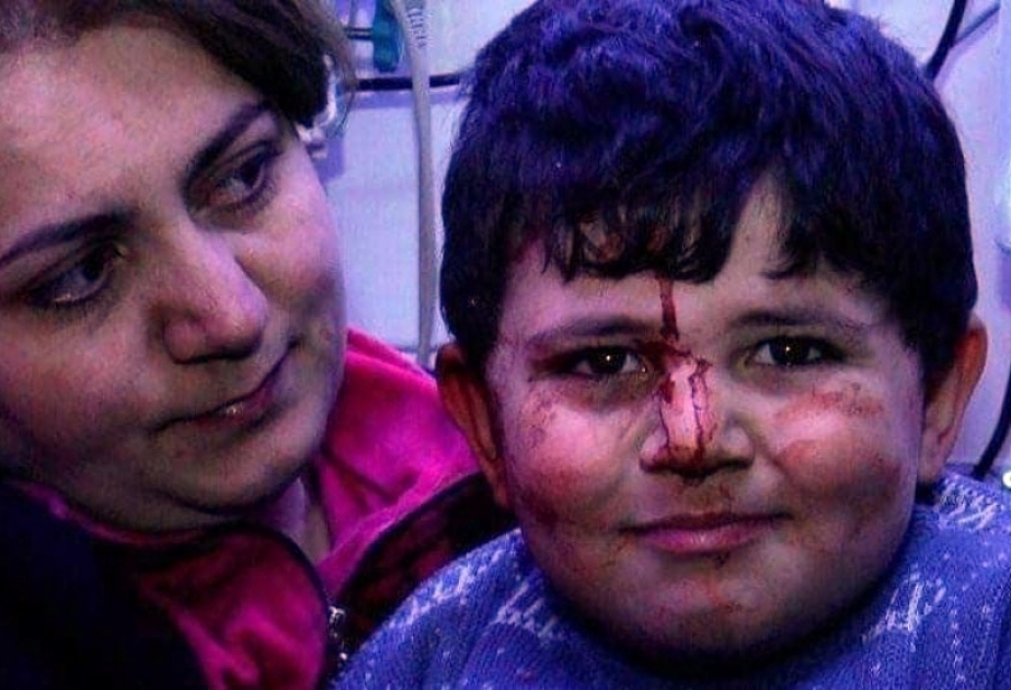 Cuando los niños azerbaiyanos son "diferentes" de los demás...