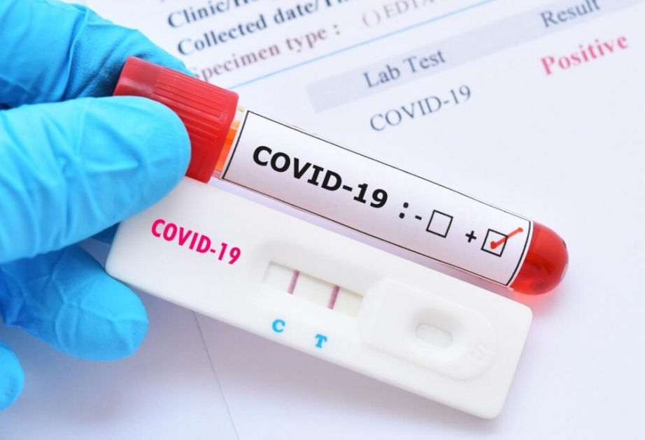 Coronavirus in Aserbaidschan: Seit Ausbruch der Pandemie wurden insgesamt 7. 382.375 Corona-Tests durchgeführt