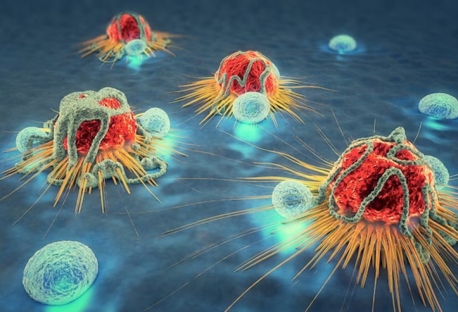 Forscher entwickeln Test, der verschiedene Krebsarten in frühem Stadium entdecken soll

