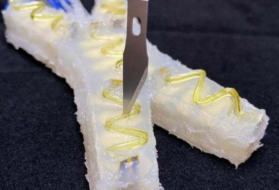 Amerikalı mütəxəssislər özünü “müalicə” edə bilən robot yaradıblar