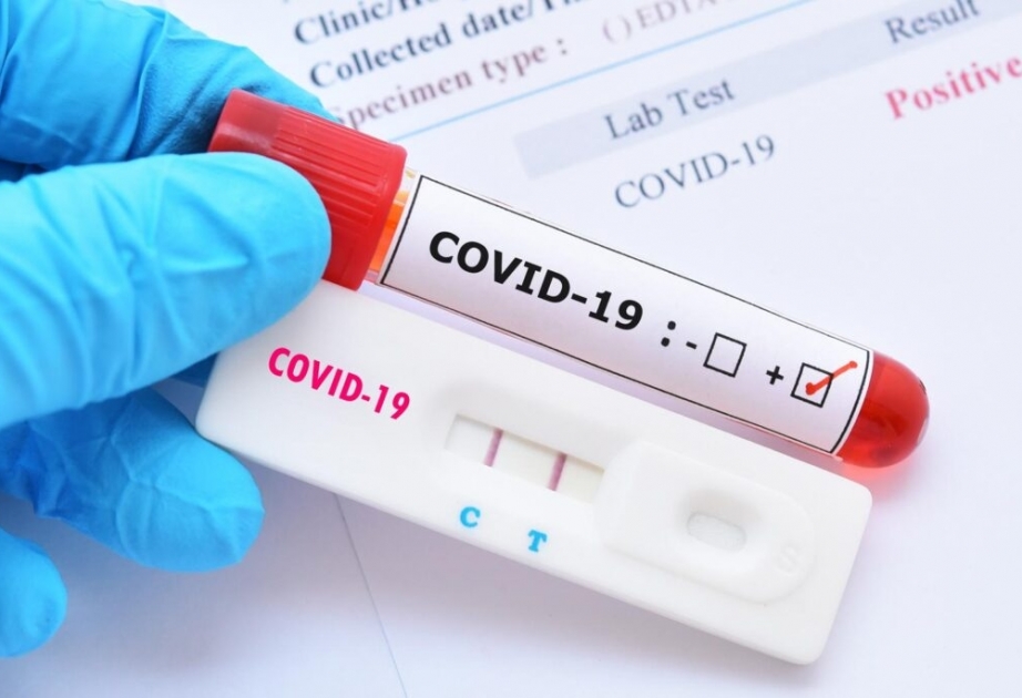 Coronavirus in Aserbaidschan: Seit Ausbruch der Pandemie wurden insgesamt 7.468.434 Corona-Tests durchgeführt
